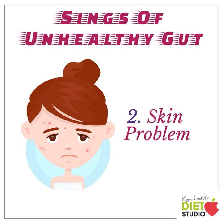 Skin conditions like eczema may be related to a damaged gut. 
The eczema is the result of an immune response within the body. Especially within the gut. Inflammation in the gut caused by a poor diet or food allergies may irritate the skin and cause conditions such as eczema. 
Take a probiotic to rebalance the gut 
#gut #guthealth #skin